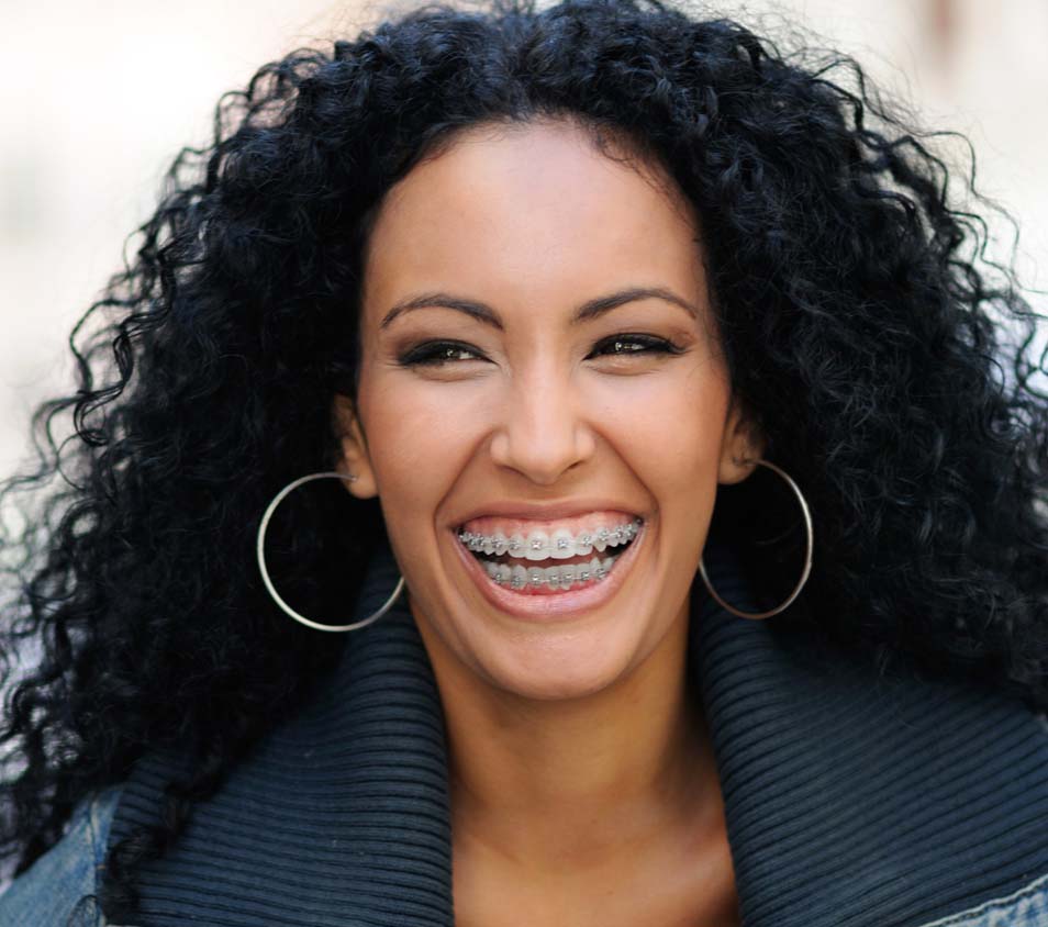 Davie Adult Orthodontics