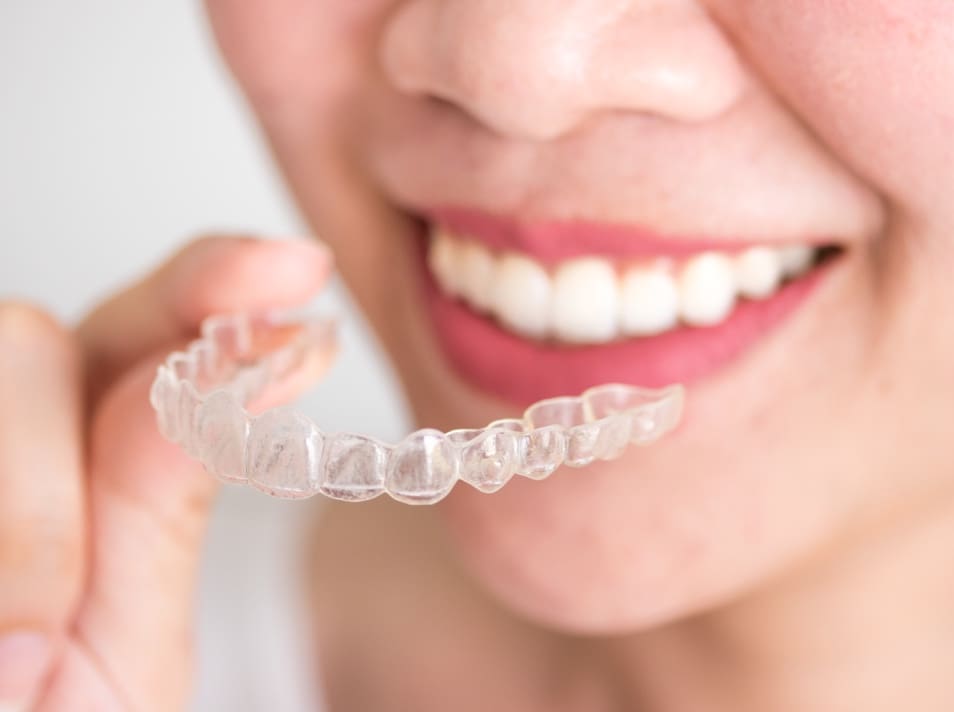Invisalign