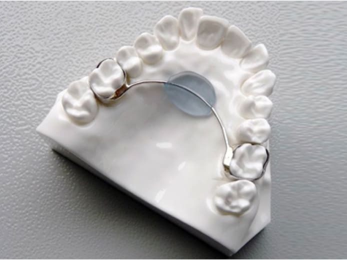 braces