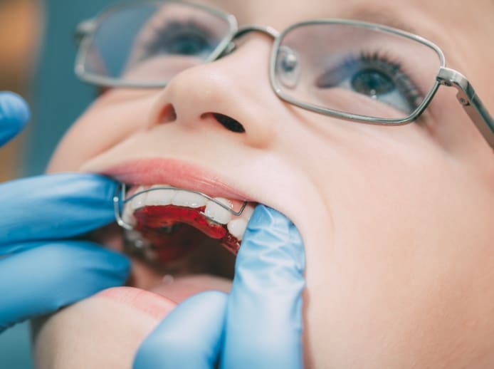 looking at a kids braces
