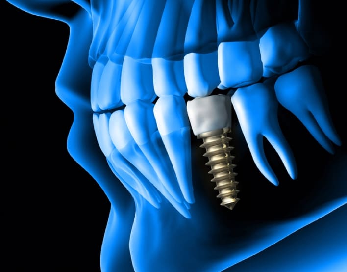 Tamarac dentist